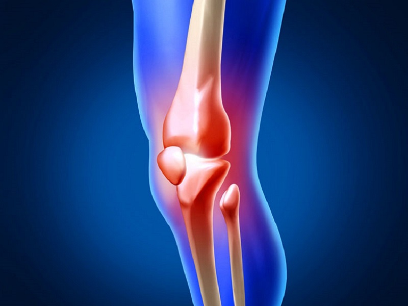 Фото снимок КТ коленного сустава здорового человека (норма)