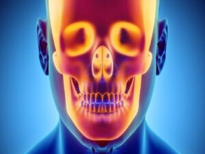 кт кісток черепа