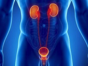 КТ сечовивідної системи в Києві