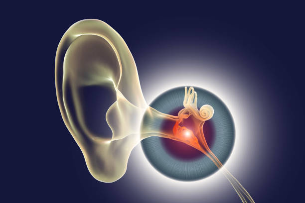 Otitis media, a group of inflammatory diseases of the middle ear, 3D illustration